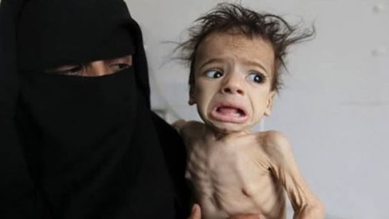 പട്ടിണി മൂലം ഓരോ മണിക്കൂറിലും ആറ് കുഞ്ഞുങ്ങള് വീതം മരിച്ചുവീഴുന്ന നാട് പട്ടിണി മൂലം ഓരോ മണിക്കൂറിലും ആറ് കുഞ്ഞുങ്ങള് വീതം മരിച്ചുവീഴുന്ന നാട്