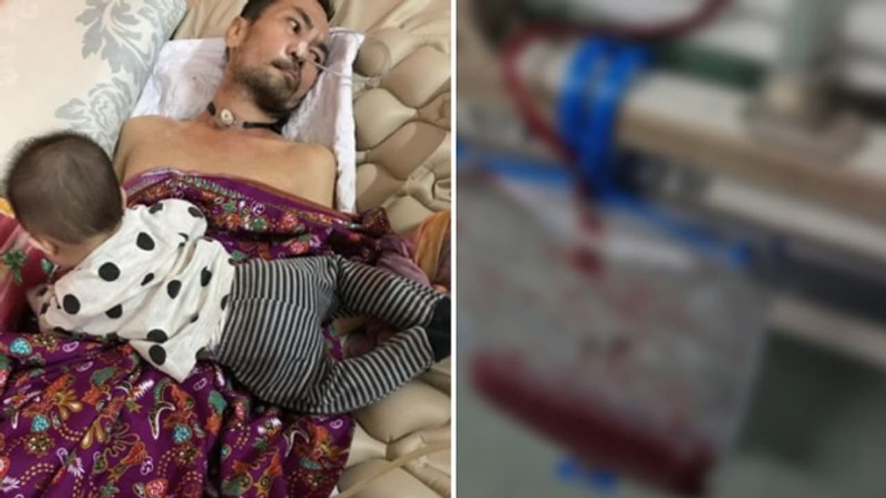 पेशाब की नली में घुसा दी गलत पाइप, दर्द से छटपटाता रहा शख्स पेशाब की नली में घुसा दी गलत पाइप, दर्द से छटपटाता रहा शख्स