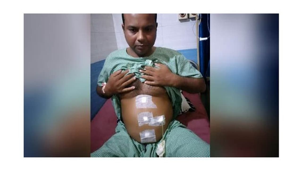 इस आदमी के शरीर में है हर अंग उलटा, 378 साल पहले ऐसा मामला आया था सामने इस आदमी के शरीर में है हर अंग उलटा, 378 साल पहले ऐसा मामला आया था सामने