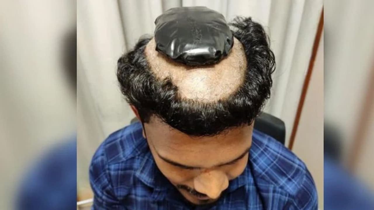 తలకు గుండు.. విగ్గులో గోల్డ్: కొచ్చి అడ్డంగా బుక్కయిన యువకుడు