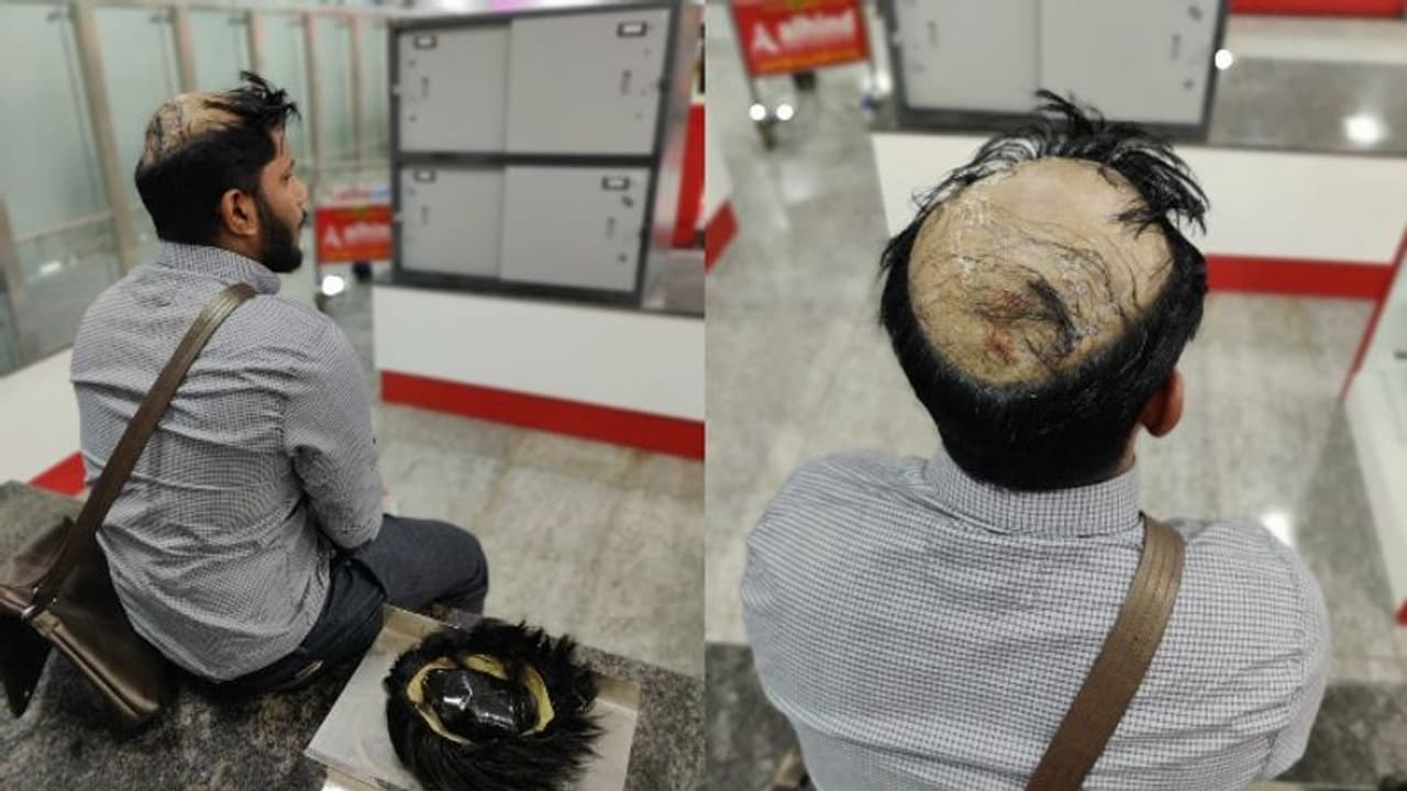 വീണ്ടും വിഗ്ഗിൽ സ്വർണം കടത്താൻ ശ്രമം; കരിപ്പൂർ വിമാനത്താവളത്തിൽ യുവാവ് പിടിയിൽ വീണ്ടും വിഗ്ഗിൽ സ്വർണം കടത്താൻ ശ്രമം; കരിപ്പൂർ വിമാനത്താവളത്തിൽ യുവാവ് പിടിയിൽ