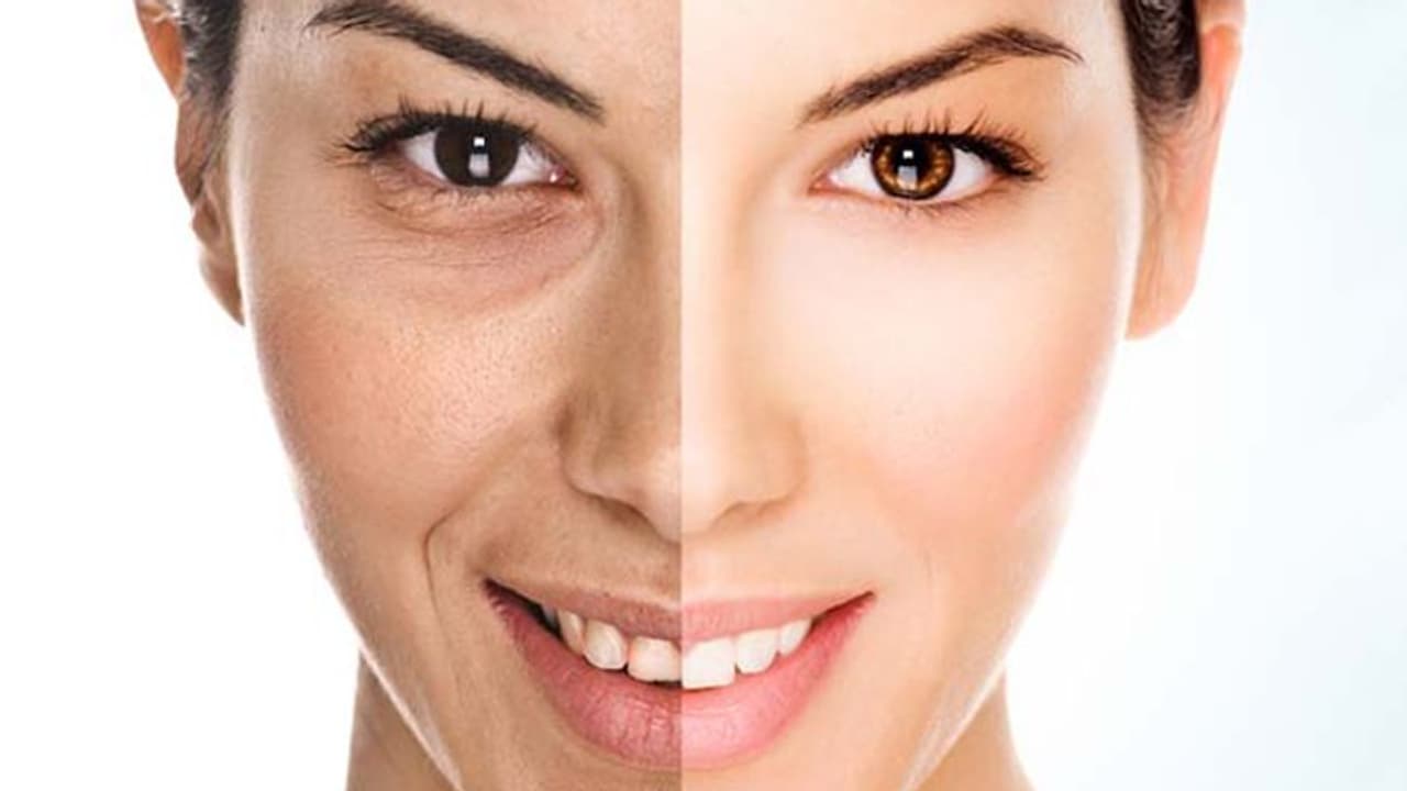 മുഖത്തെ ചുളിവുകൾ കുറയ്ക്കണോ; എങ്കിൽ ദിവസവും രണ്ടോ മൂന്നോ ബദാം കഴിക്കൂ മുഖത്തെ ചുളിവുകൾ കുറയ്ക്കണോ; എങ്കിൽ ദിവസവും രണ്ടോ മൂന്നോ ബദാം കഴിക്കൂ