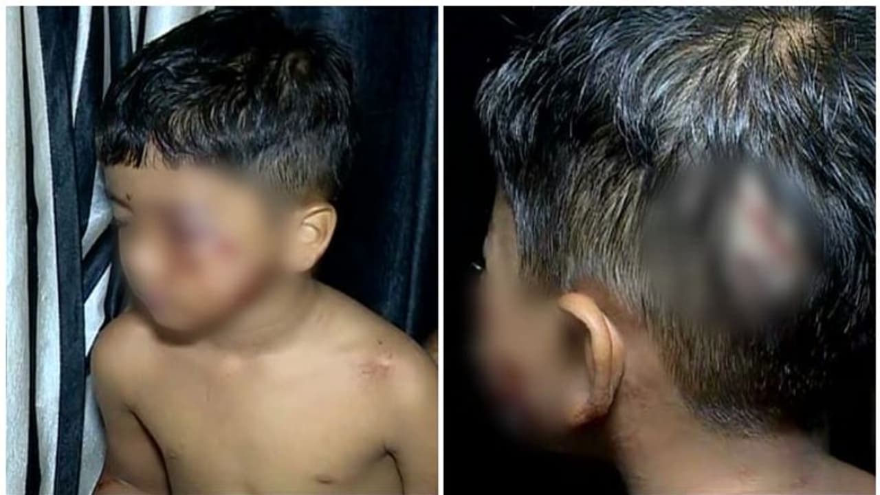 തെരുവുനായ ആക്രമണം രൂക്ഷം; പഞ്ചായത്തിനെതിരെ പ്രതിഷേധവുമായി വണ്ടൂരുകാർ തെരുവുനായ ആക്രമണം രൂക്ഷം; പഞ്ചായത്തിനെതിരെ പ്രതിഷേധവുമായി വണ്ടൂരുകാർ