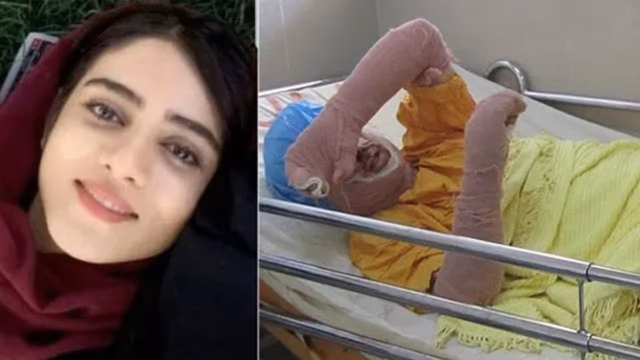 लड़का बनकर फुटबॉल मैच देखने गई थी, पकड़ी गई तो खुद को लगा ली आग, लेकिन बदल दिया इतिहास लड़का बनकर फुटबॉल मैच देखने गई थी, पकड़ी गई तो खुद को लगा ली आग, लेकिन बदल दिया इतिहास