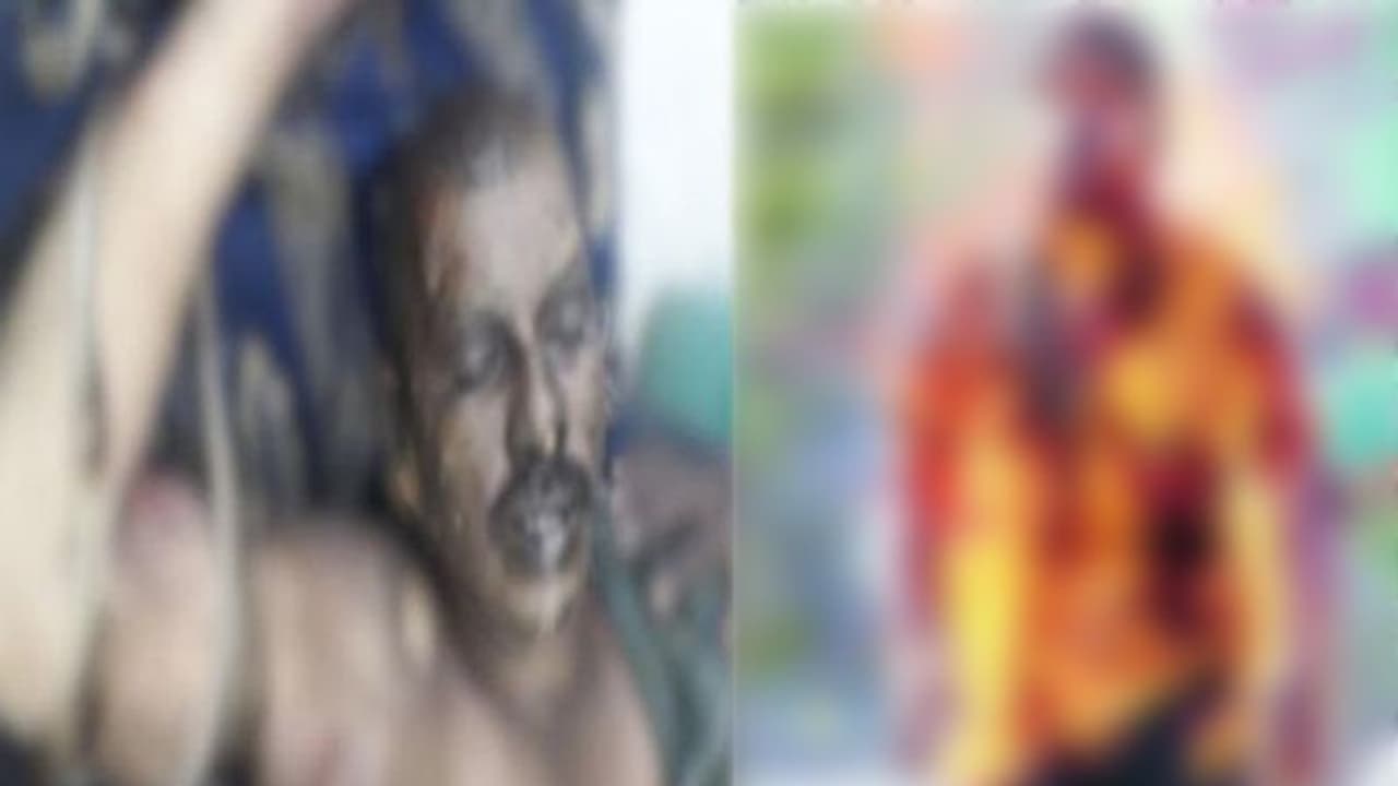 నాడైనా నేడైనా తెలంగాణ ప్రజల ప్రాణాలు తృణప్రాయమేనా? నాడైనా నేడైనా తెలంగాణ ప్రజల ప్రాణాలు తృణప్రాయమేనా?