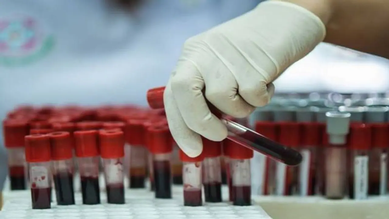 ಕೊಡಗು ಜಿಲ್ಲೆಯಲ್ಲಿ ರಕ್ತ ವಿದಳನ ಘಟಕ ಆರಂಭ ಕೊಡಗು ಜಿಲ್ಲೆಯಲ್ಲಿ ರಕ್ತ ವಿದಳನ ಘಟಕ ಆರಂಭ