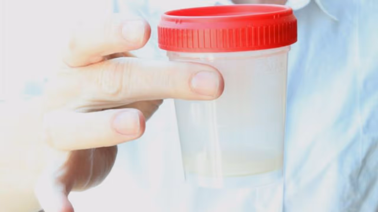 Sperm Count : പുരുഷന്മാര്‍ അറിയേണ്ടത്; ബീജത്തിന്‍റെ കൗണ്ട് കുറയുന്നതിന് പിന്നിലെ പ്രധാന കാരണം...