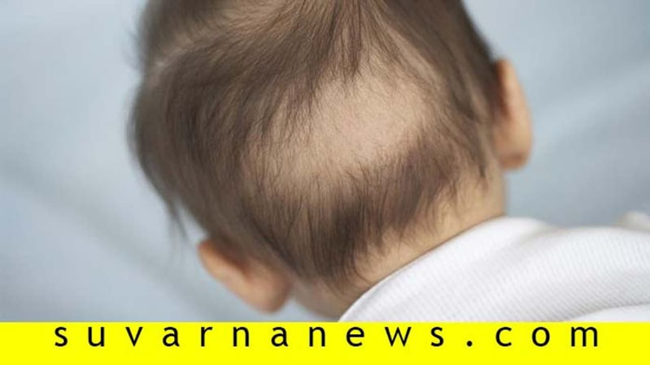 ನಿಮ್ಮ ಮನೆಯಲ್ಲೊಂದು ಬೋಳುಗುಂಡ ಇದ್ಯಾ? ಕೂದಲು ಉದುರುವುದಕ್ಕೆ ಕಾರಣಗಳಿವು