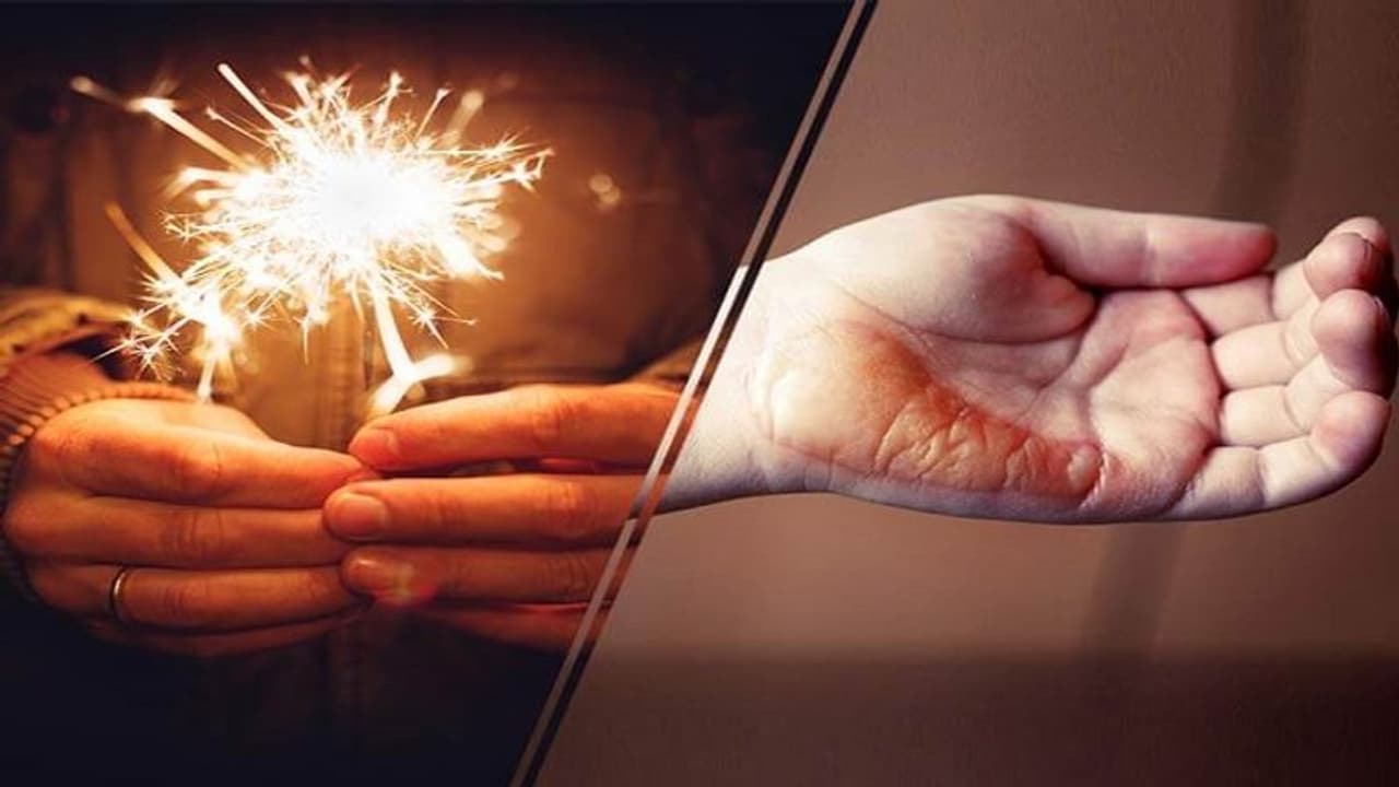 जल जाने पर करें ये 5 उपाय, मिलेगा जल्दी आराम जल जाने पर करें ये 5 उपाय, मिलेगा जल्दी आराम