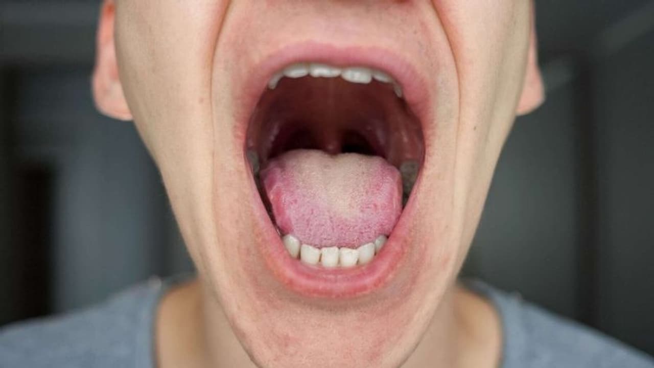 അറുപതുകാരന് രുചി അറിയാനുളള കഴിവ് നഷ്ടപ്പെട്ടു ; കാരണം ഇതാണ്...