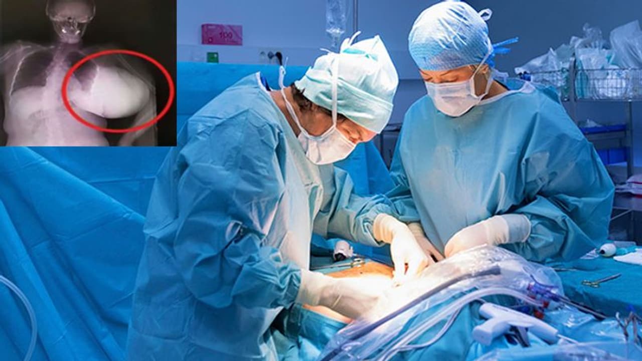 ഇടത് സ്തനത്തിന് ചില മാറ്റങ്ങൾ വരുന്നതായി യുവതി ശ്രദ്ധിച്ചു; പരിശോധനയിൽ കണ്ടെത്തിയത്...