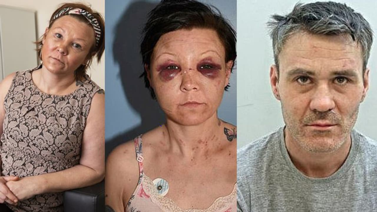 ചുറ്റികകൊണ്ട് തലയ്ക്കടിച്ചു, കത്തി ഉപയോ​ഗിച്ച് ശരീരത്തിൽ മുറിവേൽപ്പിച്ചു, കാമുകന്റെ ക്രൂരത തീരുന്നില്ല...