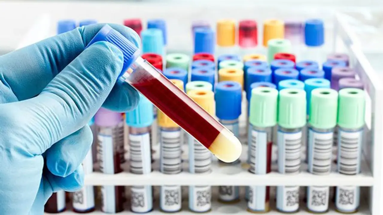 கொரோனா பரிசோதனை முடிவுகள் உடனுக்குடன் கிடைக்க அதிரடி நடவடிக்கை..!! புதிதாக 18 தனியார் நிறுவனங்களுக்கு அனுமதி கொரோனா பரிசோதனை முடிவுகள் உடனுக்குடன் கிடைக்க அதிரடி நடவடிக்கை..!! புதிதாக 18 தனியார் நிறுவனங்களுக்கு அனுமதி