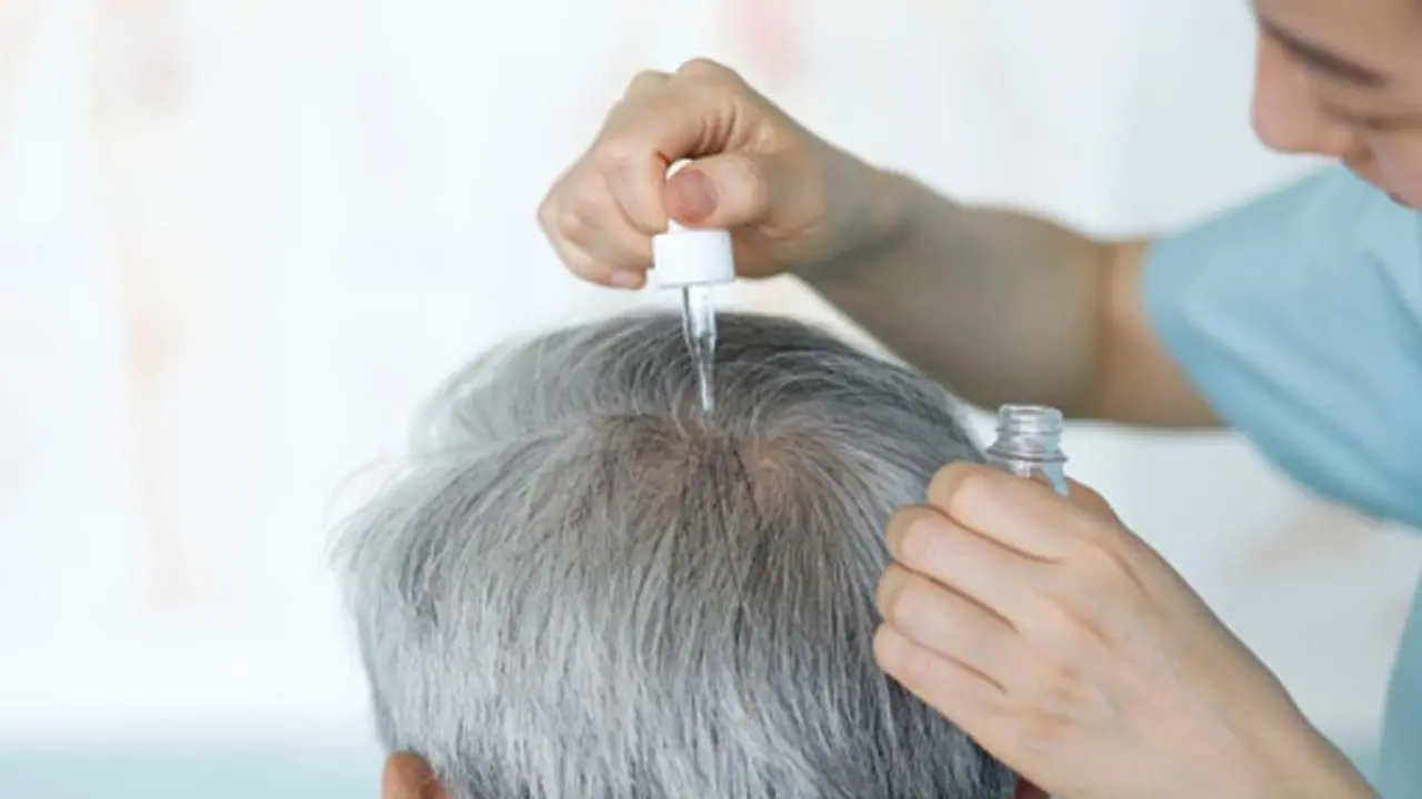 অকালে চুল পেকে যাচ্ছে, শুধু বদল আনুন খাবার পাতে অকালে চুল পেকে যাচ্ছে, শুধু বদল আনুন খাবার পাতে