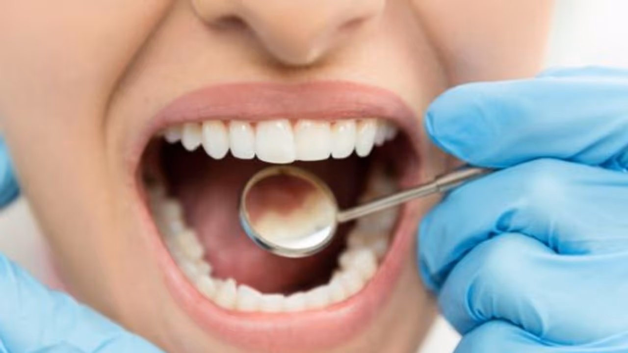 പല്ലിന്റെ ആരോഗ്യം സംരക്ഷിക്കുന്നതിലൂടെ നാം തടയുന്ന രോഗങ്ങള്... പല്ലിന്റെ ആരോഗ്യം സംരക്ഷിക്കുന്നതിലൂടെ നാം തടയുന്ന രോഗങ്ങള്...