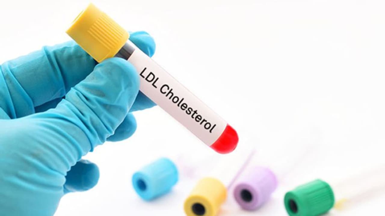 മോശം കൊളസ്ട്രോൾ കുറയ്ക്കാൻ 5 കാര്യങ്ങൾ ശ്രദ്ധിച്ചാൽ മതി മോശം കൊളസ്ട്രോൾ കുറയ്ക്കാൻ 5 കാര്യങ്ങൾ ശ്രദ്ധിച്ചാൽ മതി