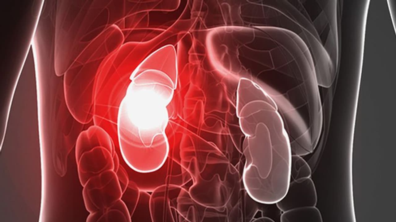 ഈ 3 കാര്യങ്ങൾ ശ്രദ്ധിച്ചാൽ വൃക്കരോഗം വരാതെ സൂക്ഷിക്കാം ഈ 3 കാര്യങ്ങൾ ശ്രദ്ധിച്ചാൽ വൃക്കരോഗം വരാതെ സൂക്ഷിക്കാം