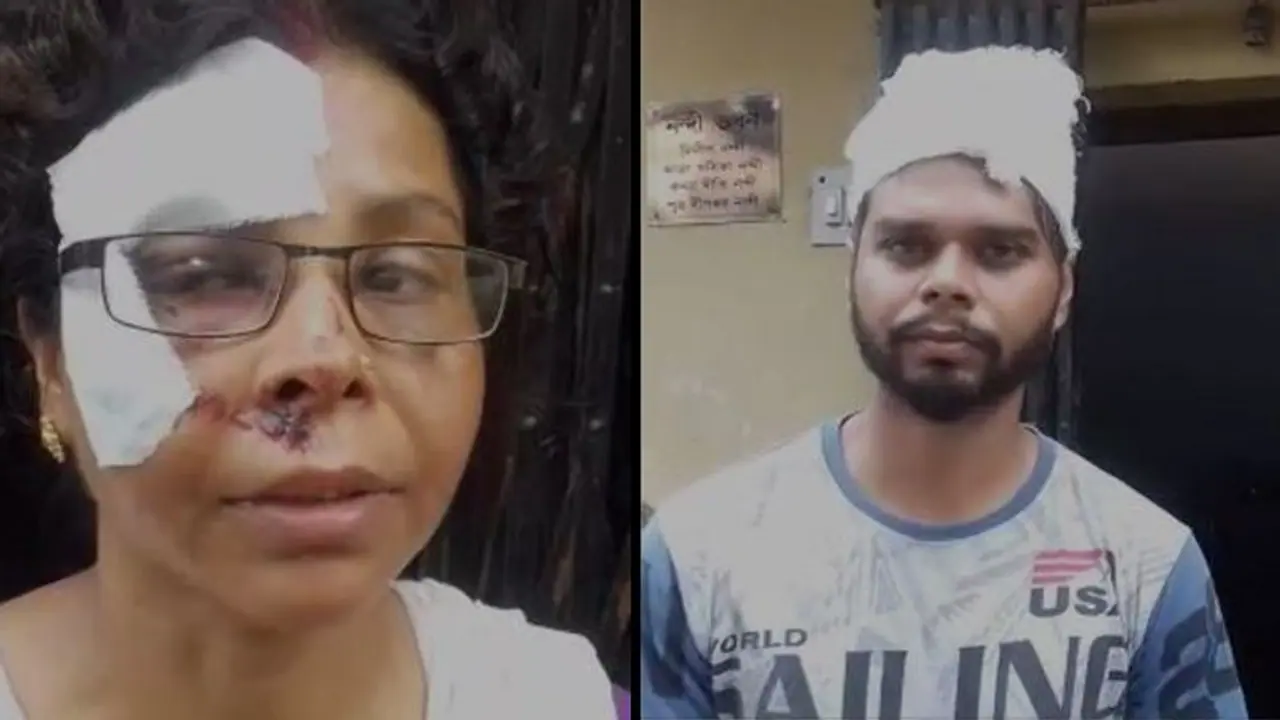 পশুপ্রেমের মাশুল, খড়দহে আক্রান্ত মা ও ছেলে পশুপ্রেমের মাশুল, খড়দহে আক্রান্ত মা ও ছেলে