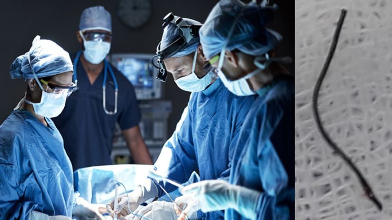 സി ടി സ്കാനിലും എന്ഡോസ്കോപിയിലും കണ്ടെത്തിയില്ല; യുവാവിന്റെ തൊണ്ടയില് കുടുങ്ങിയ കമ്പി കഷ്ണം പുറത്തെടുത്തത് ഇങ്ങനെ സി ടി സ്കാനിലും എന്ഡോസ്കോപിയിലും കണ്ടെത്തിയില്ല; യുവാവിന്റെ തൊണ്ടയില് കുടുങ്ങിയ കമ്പി കഷ്ണം പുറത്തെടുത്തത് ഇങ്ങനെ