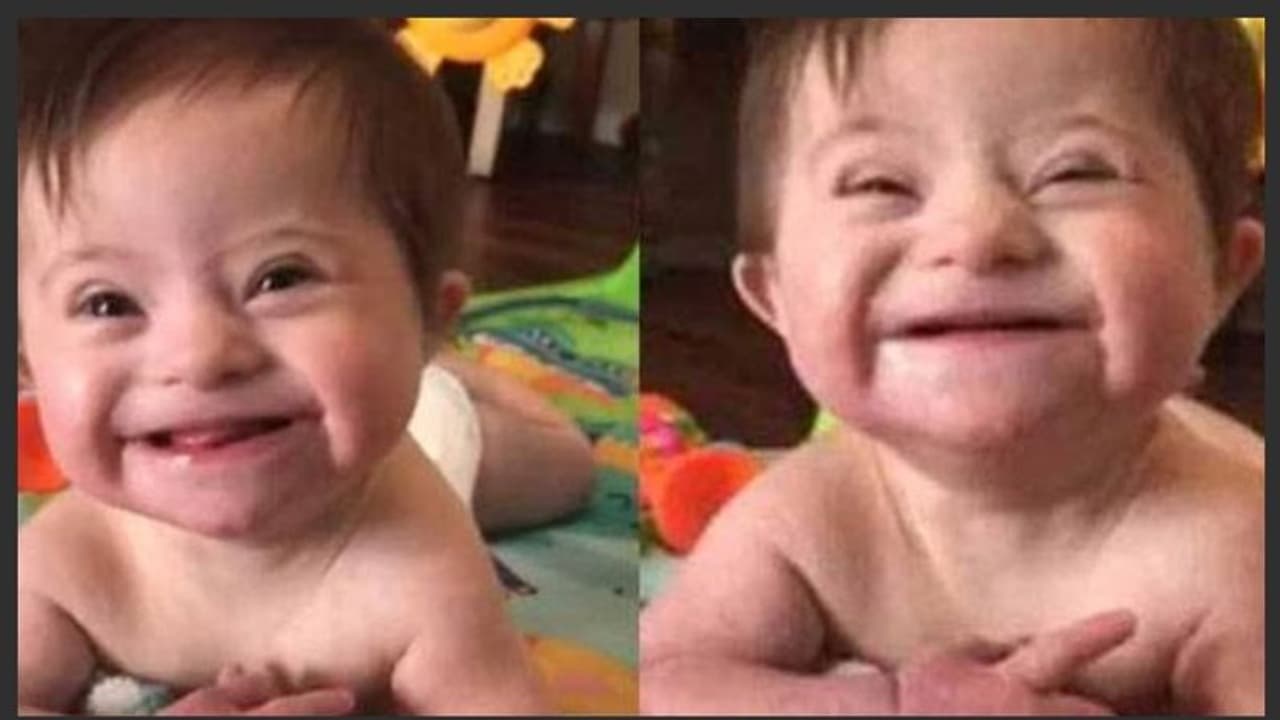 എന്തൊരു മനോഹരം..ഈ പുഞ്ചിരിക്ക് പിന്നില്‍ ഒരു വേദനയുണ്ട്.!