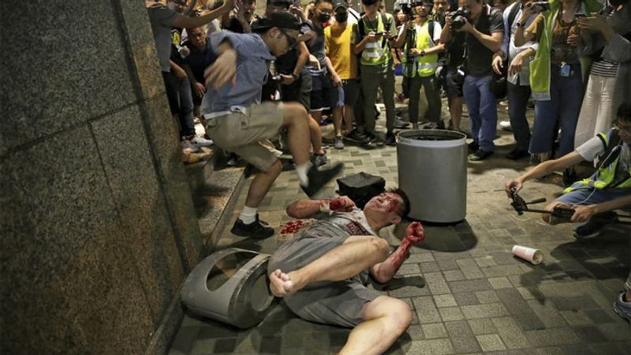 हांगकांग का खूनी खेल हमलावर ने नेता का कान काटा , 5 लोगों पर किया चाकू से वार हांगकांग का खूनी खेल हमलावर ने नेता का कान काटा , 5 लोगों पर किया चाकू से वार