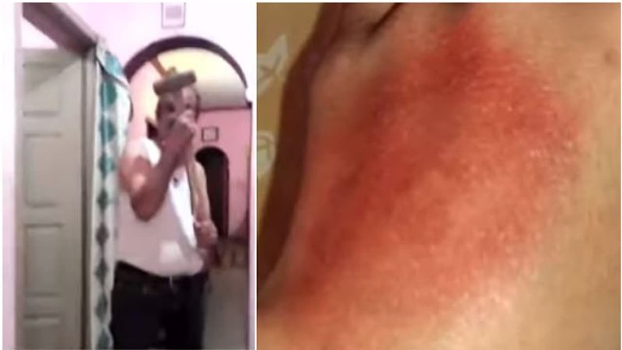 കെജിഎഫ് സിനിമയിലെ ഡയലോഗ് പറഞ്ഞ് 10 വയസുകാരിയെ ചുറ്റിക കൊണ്ട് അടിച്ചു; അച്ഛന്‍ അറസ്റ്റില്‍