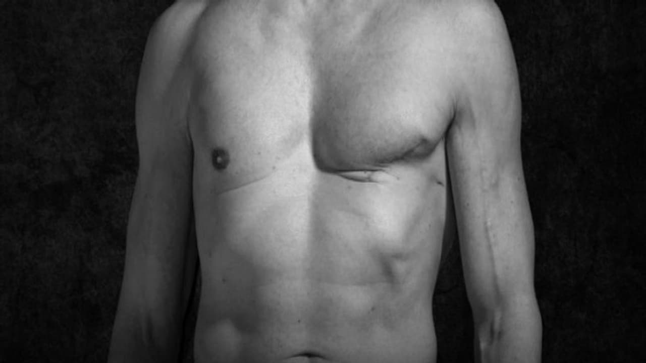 पुरुषों को भी हो रही ब्रेस्ट कैंसर की बीमारी, रहें अलर्ट पुरुषों को भी हो रही ब्रेस्ट कैंसर की बीमारी, रहें अलर्ट