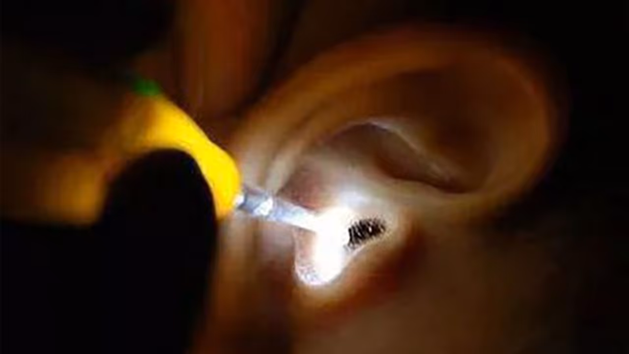 காதில் குட்டி போட்டு குடித்தனம் செய்த கரப்பான் பூச்சி ..! வாலிபரின் வலது காதில்...திக் திக் காட்சி..! காதில் குட்டி போட்டு குடித்தனம் செய்த கரப்பான் பூச்சி ..! வாலிபரின் வலது காதில்...திக் திக் காட்சி..!