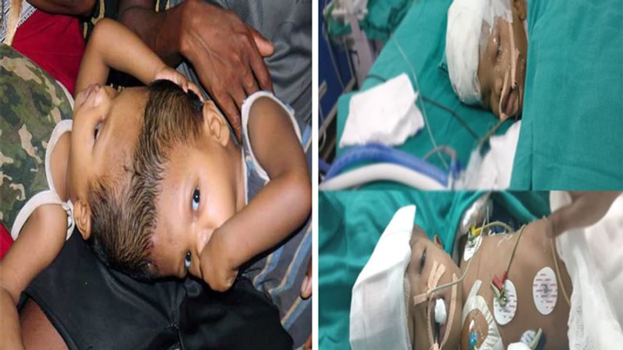 जुड़वा भाइयों के जन्म के वक्त से ही जुड़े थे सिर, इनके नाम अब दर्ज हुआ ये बड़ा रिकॉर्ड जुड़वा भाइयों के जन्म के वक्त से ही जुड़े थे सिर, इनके नाम अब दर्ज हुआ ये बड़ा रिकॉर्ड