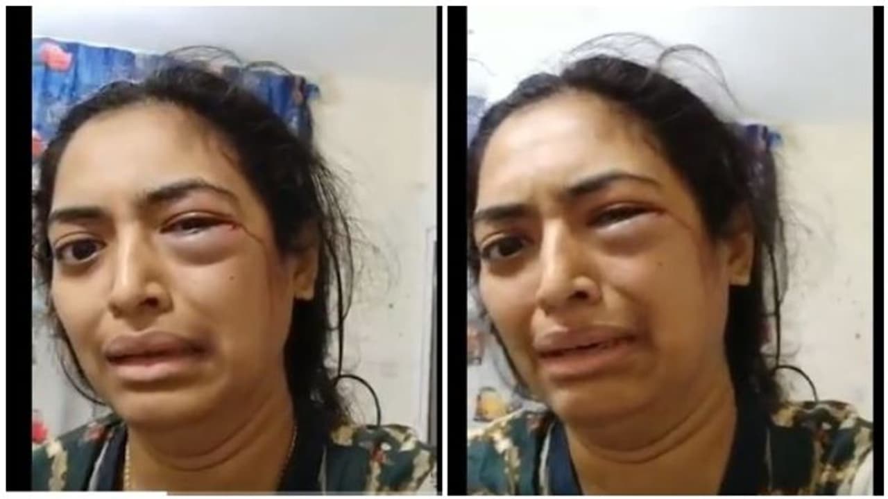 என் புருஷன் அடிச்சு கொல்றான் காப்பாத்துங்க... ரத்தத்துடன் வீடியோ வெளியிட்டு பதற வைக்கும் இளம்பெண்..! என் புருஷன் அடிச்சு கொல்றான் காப்பாத்துங்க... ரத்தத்துடன் வீடியோ வெளியிட்டு பதற வைக்கும் இளம்பெண்..!