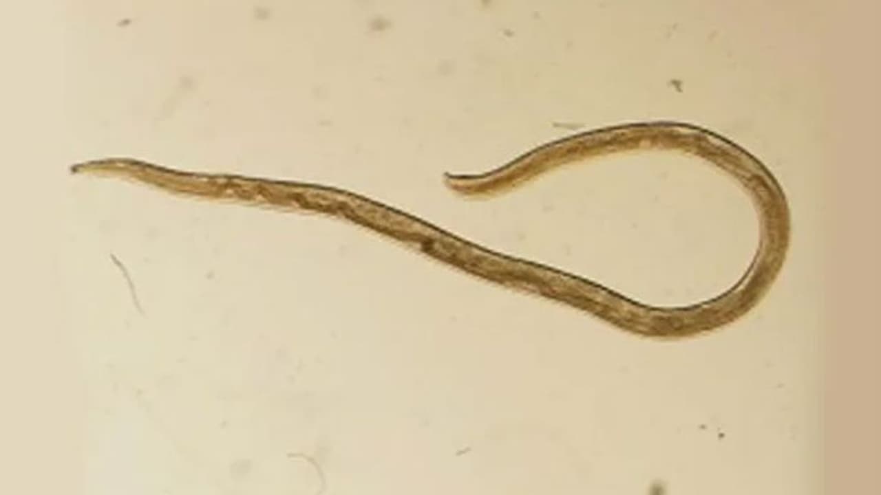 ചൊറിച്ചിലും അസ്വസ്ഥതയും; കണ്ണ് തിരുമ്മിയപ്പോള് കിട്ടിയത്... ചൊറിച്ചിലും അസ്വസ്ഥതയും; കണ്ണ് തിരുമ്മിയപ്പോള് കിട്ടിയത്...