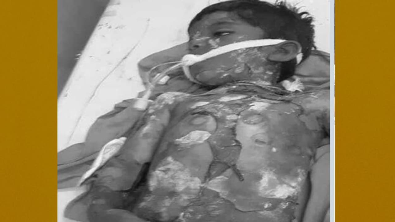 విషాదం...ఆరేళ్ల బాలుడిని బలితీసుకున్న వేడి సాంబారు విషాదం...ఆరేళ్ల బాలుడిని బలితీసుకున్న వేడి సాంబారు