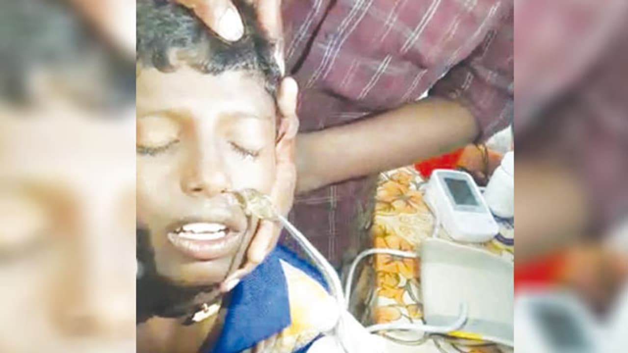 சிறுவன் மூக்கில் உயிருடன் சிக்கிய குட்டி மீன்..! கிணற்றில் குதித்து குளித்தபோது நிகழ்ந்த விபரீதம்..!