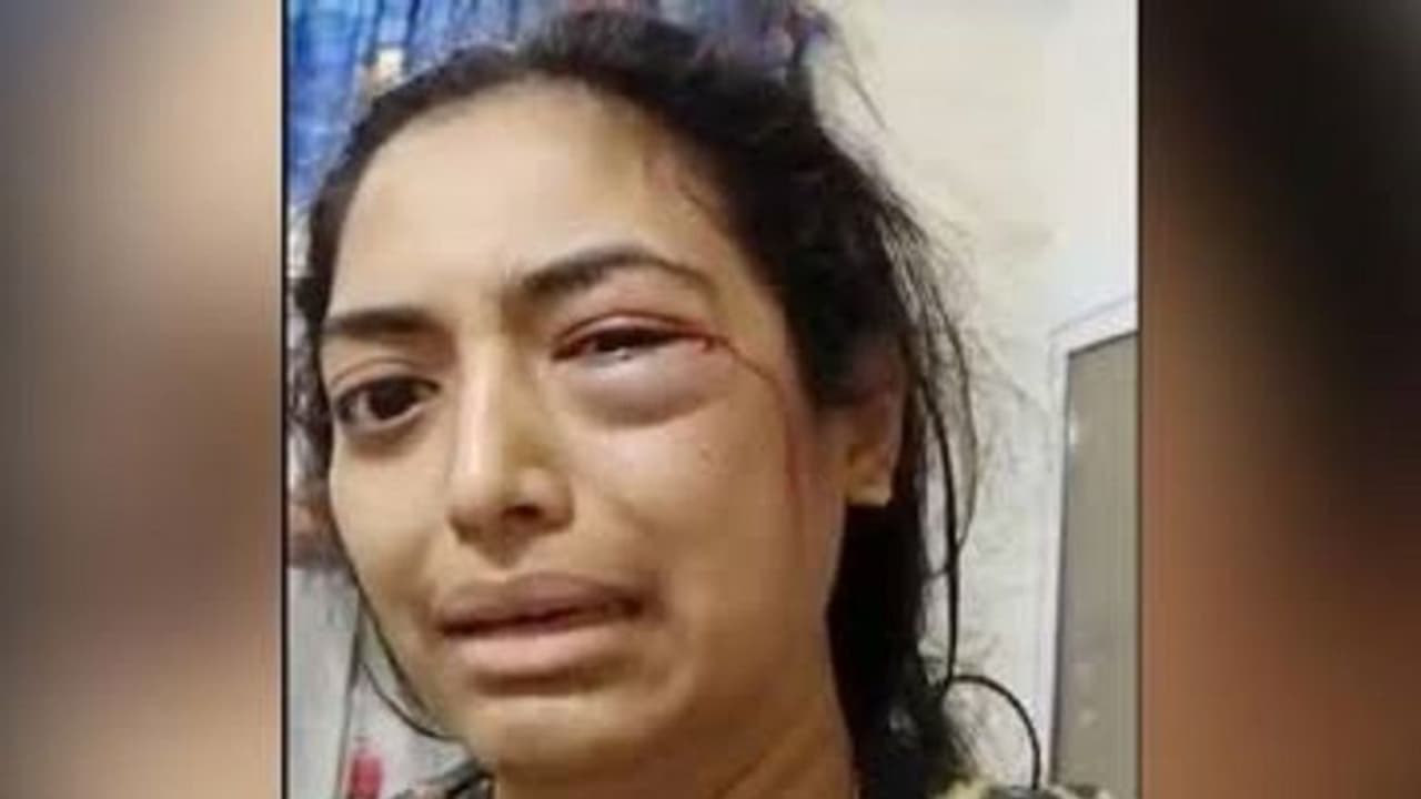 सूज गई आंख निकलने लगा खून...वीडियो पोस्ट कर महिला ने कहा जानवर है मेरा पति सूज गई आंख निकलने लगा खून...वीडियो पोस्ट कर महिला ने कहा जानवर है मेरा पति