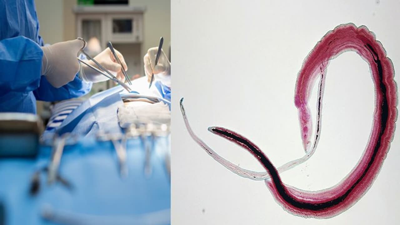 ലിംഗത്തിനുള്ളില് മുട്ടയിട്ട് വിര; യുവാവ് മരണത്തില് നിന്ന് രക്ഷപ്പെട്ടത് കഷ്ടിച്ചത് ലിംഗത്തിനുള്ളില് മുട്ടയിട്ട് വിര; യുവാവ് മരണത്തില് നിന്ന് രക്ഷപ്പെട്ടത് കഷ്ടിച്ചത്