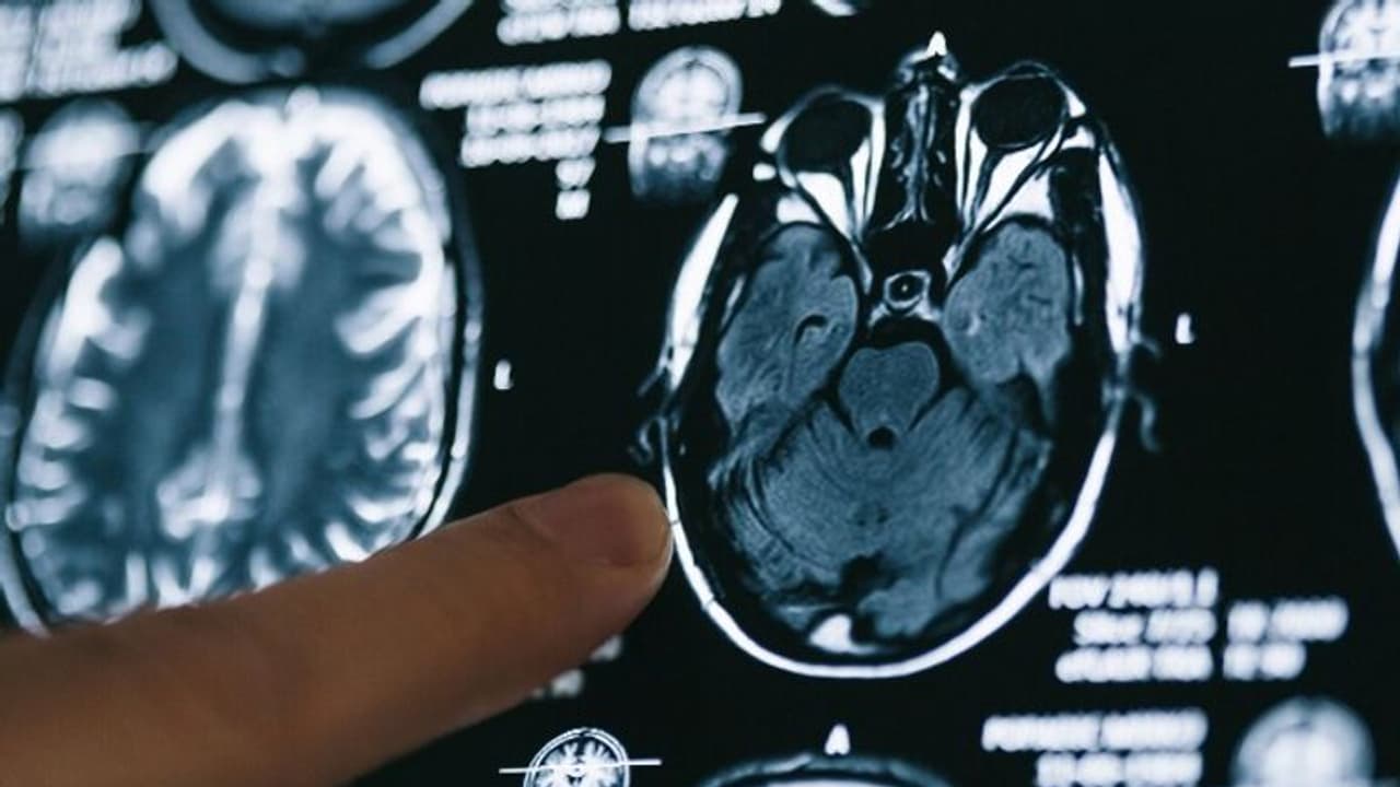 സ്കാൻ റിപ്പോര്ട്ട് അവഗണിച്ചു; ബ്രെയിന് ട്യൂമര് ബാധിച്ച് മരിച്ച 25 വയസുകാരന് ചികിത്സ ലഭിച്ചില്ലെന്ന് കുടുംബം സ്കാൻ റിപ്പോര്ട്ട് അവഗണിച്ചു; ബ്രെയിന് ട്യൂമര് ബാധിച്ച് മരിച്ച 25 വയസുകാരന് ചികിത്സ ലഭിച്ചില്ലെന്ന് കുടുംബം