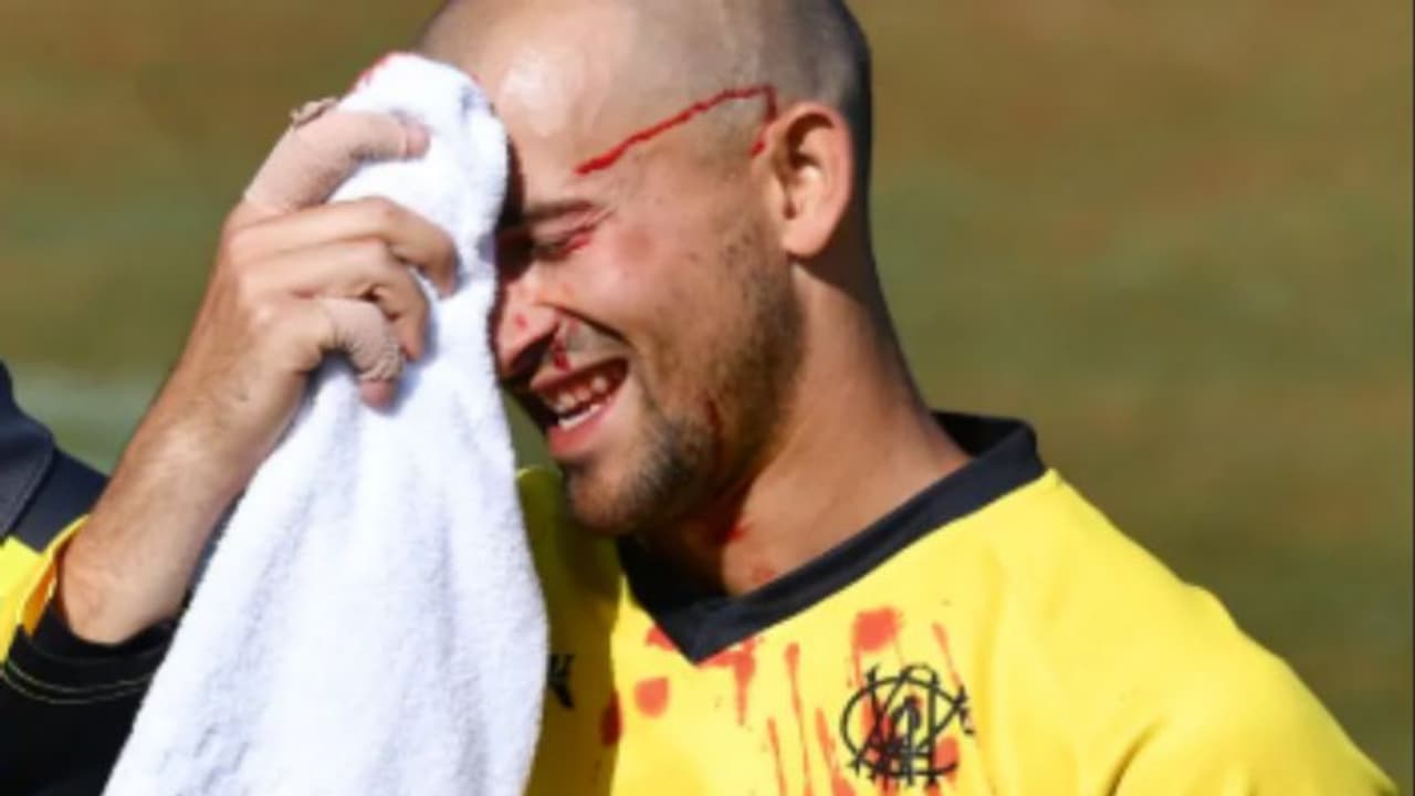 ஆஸ்திரேலிய வீரருக்கு பந்து நெற்றிப்பொட்டில் அடித்து பொள பொளனு கொட்டிய ரத்தம்.. பார்ப்போரை பதறவைக்கும் வீடியோ ஆஸ்திரேலிய வீரருக்கு பந்து நெற்றிப்பொட்டில் அடித்து பொள பொளனு கொட்டிய ரத்தம்.. பார்ப்போரை பதறவைக்கும் வீடியோ