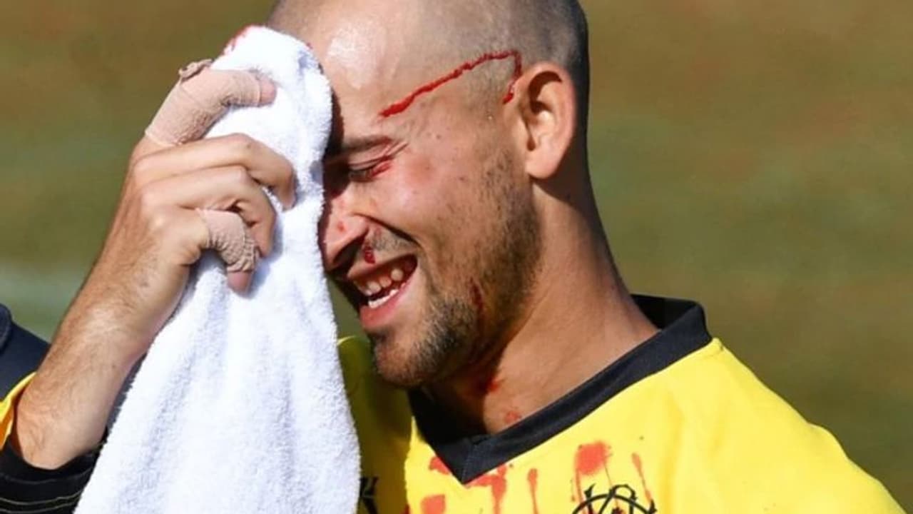 తమ్ముడు కొట్టిన షాట్.. అన్న ముక్కు పంక్చర్ తమ్ముడు కొట్టిన షాట్.. అన్న ముక్కు పంక్చర్