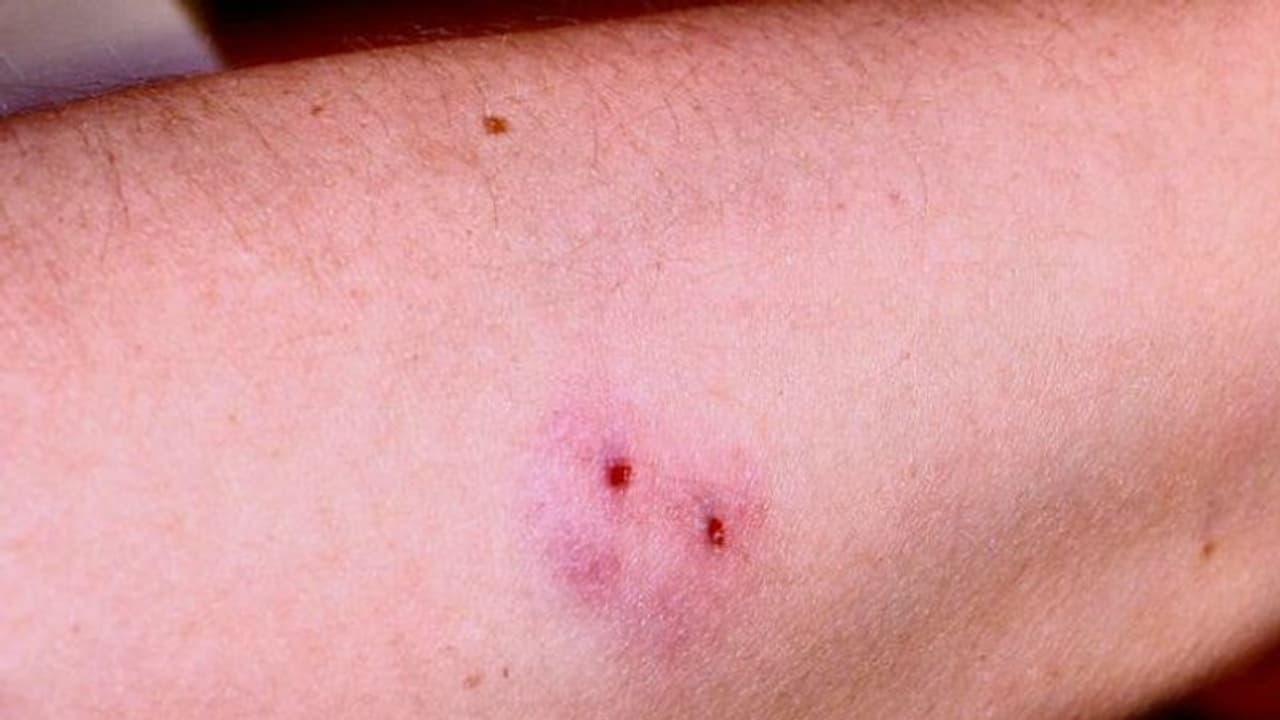 വയനാട്ടിൽ സ്കൂള് മുറ്റത്ത് വച്ച് വിദ്യാർത്ഥിക്ക് പാമ്പുകടിയേറ്റു; കുട്ടി ചികിത്സയിൽ വയനാട്ടിൽ സ്കൂള് മുറ്റത്ത് വച്ച് വിദ്യാർത്ഥിക്ക് പാമ്പുകടിയേറ്റു; കുട്ടി ചികിത്സയിൽ