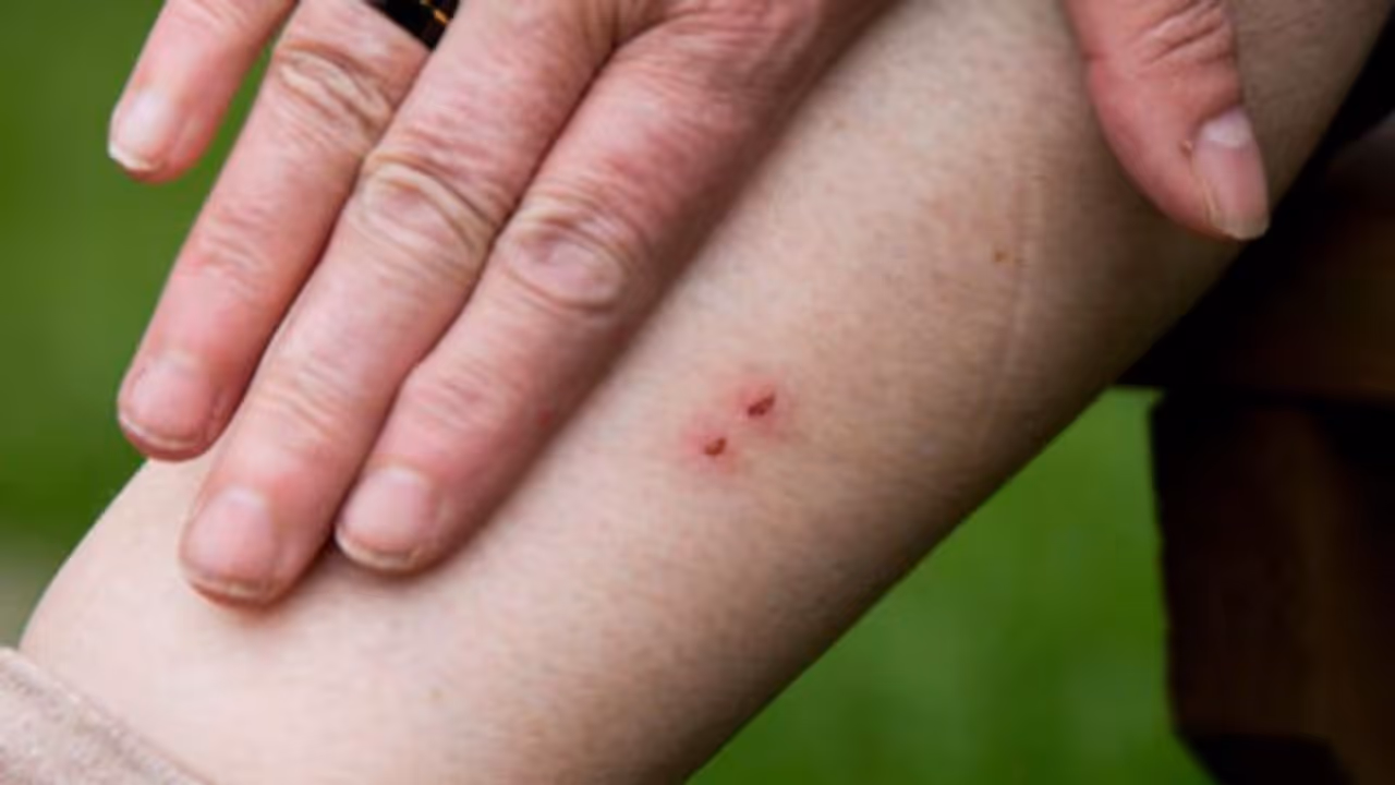 ചാലക്കുടിയില് വിദ്യാര്ത്ഥിനിക്ക് പാമ്പ് കടിയേറ്റ സംഭവം; ആരോഗ്യനിലയിൽ ആശങ്കപ്പെടാനില്ലെന്ന് ഡോക്ടര് ചാലക്കുടിയില് വിദ്യാര്ത്ഥിനിക്ക് പാമ്പ് കടിയേറ്റ സംഭവം; ആരോഗ്യനിലയിൽ ആശങ്കപ്പെടാനില്ലെന്ന് ഡോക്ടര്