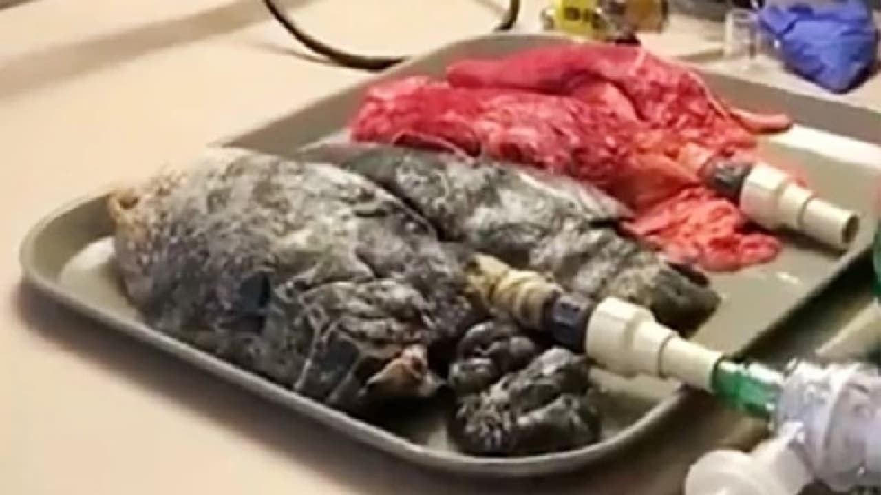 ನೀವೂ ಸಿಗರೇಟ್ ಸೇದ್ತೀರಾ? ಈ ವಿಡಿಯೋ ಒಮ್ಮೆ ನೋಡ್ಬಿಡಿ!