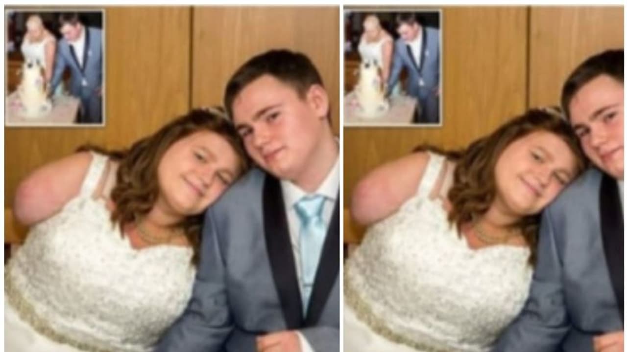 புற்றுநோயால் 2 கைகளை இழந்த காதலி..! கைவிடாத காதலன்..."அவள் தான் என் மனைவி".. வைரலாகும் திருமண புகைப்படம்...! புற்றுநோயால் 2 கைகளை இழந்த காதலி..! கைவிடாத காதலன்..."அவள் தான் என் மனைவி".. வைரலாகும் திருமண புகைப்படம்...!