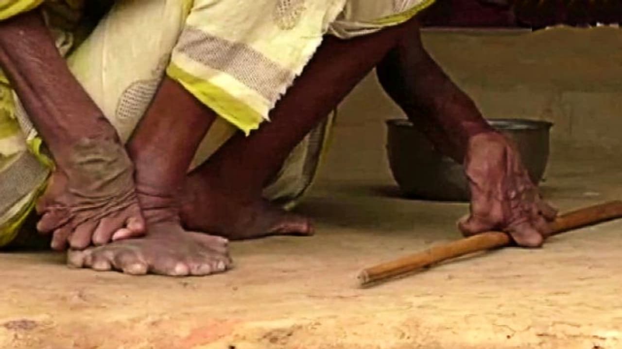 হাতে ১২টি আঙুল, পায়ে ২০টি, একলাই দিন কাটে গঞ্জমের 'ডাইনি বুড়ি'র হাতে ১২টি আঙুল, পায়ে ২০টি, একলাই দিন কাটে গঞ্জমের 'ডাইনি বুড়ি'র