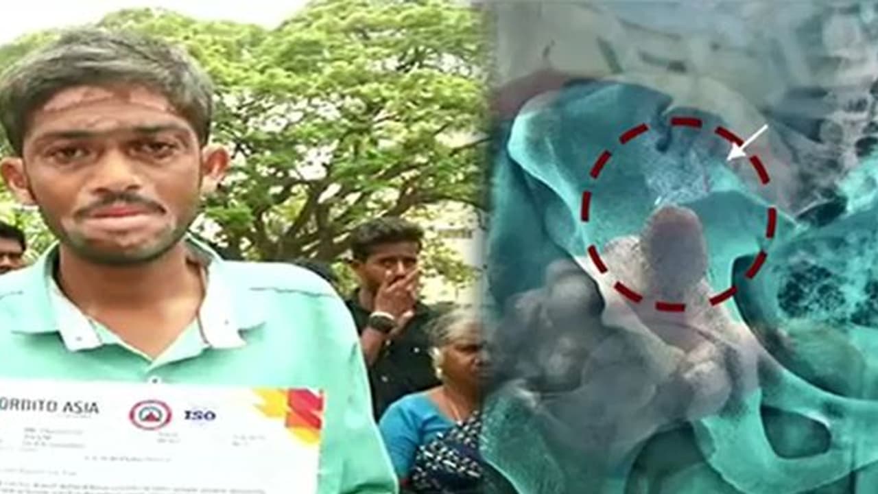 ஊசி உடைந்து வாலிபரின் உடலில் சிக்கிய பரிதாபம்..! தட்டிக்கேட்ட நோயாளியை மிரட்டிய மருத்துவமனை நிர்வாகம்..!