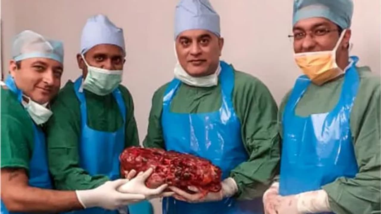 ഏഴര കിലോയോളം വരുന്ന വൃക്ക; ചരിത്രമെന്ന് ഡോക്ടര്മാര് ഏഴര കിലോയോളം വരുന്ന വൃക്ക; ചരിത്രമെന്ന് ഡോക്ടര്മാര്