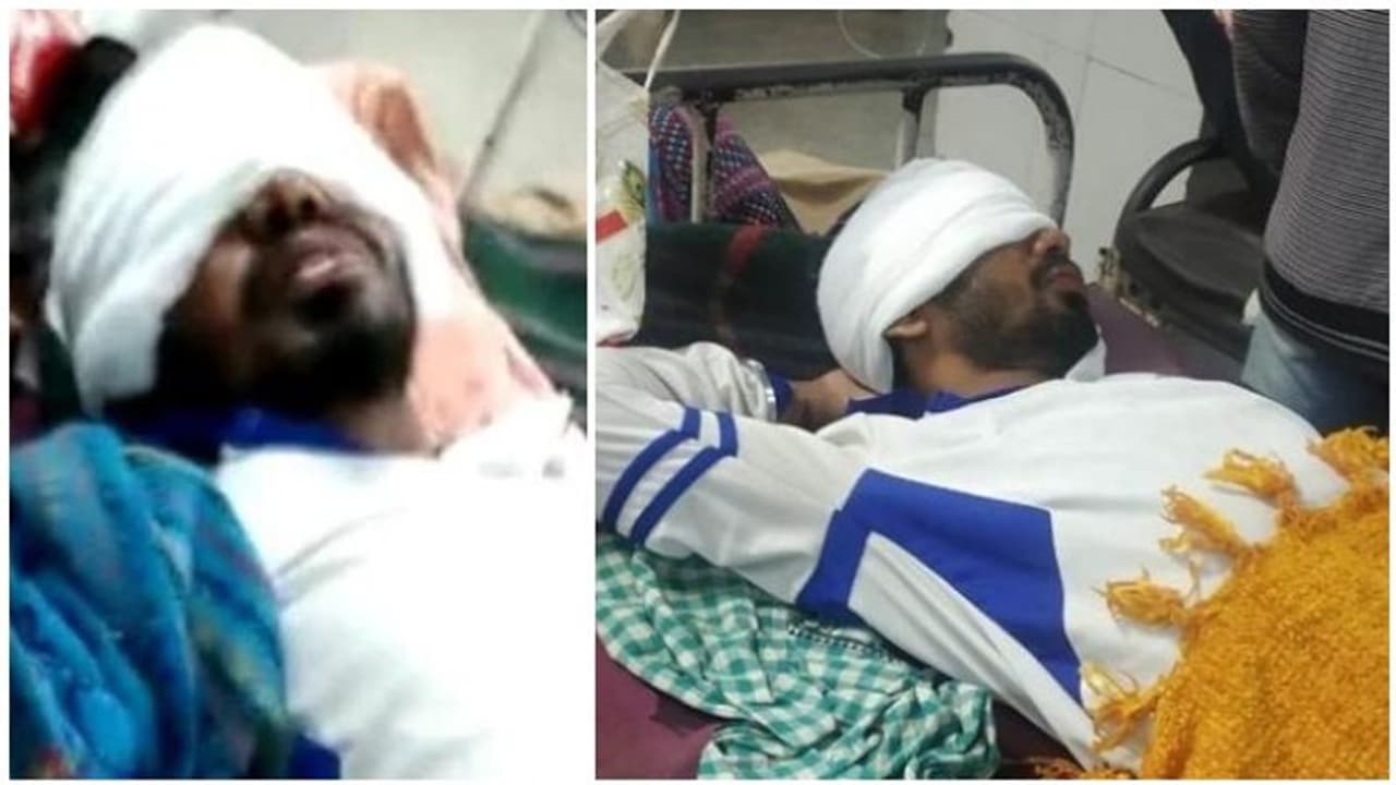 காதலன் கழட்டி விட்டதால்.... கோபத்தில் ஆசிட் வீசிய தீவிர காதலி...! மருத்துவமனையில் தவிக்கும் காதலன்..!