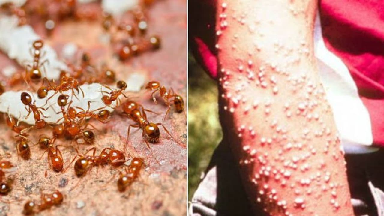 കടിച്ചാല് കുമിളകളായി അലര്ജി, ചിലപ്പോള് മരണം; ഇത്തിരിക്കുഞ്ഞന് അപകടകാരികള് കടിച്ചാല് കുമിളകളായി അലര്ജി, ചിലപ്പോള് മരണം; ഇത്തിരിക്കുഞ്ഞന് അപകടകാരികള്