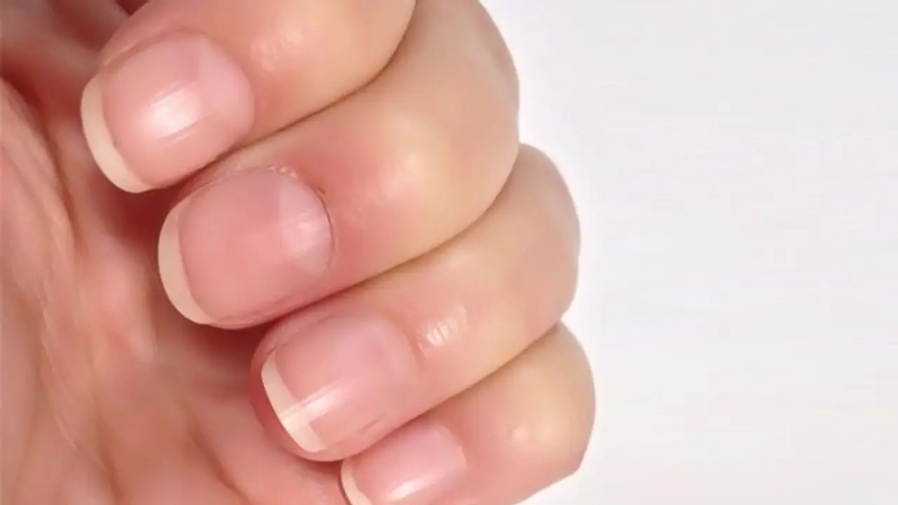 হাতের নখে এরকম দাগ রয়েছে? সাবধান হন! আসতে চলেছে বড় বিপদ