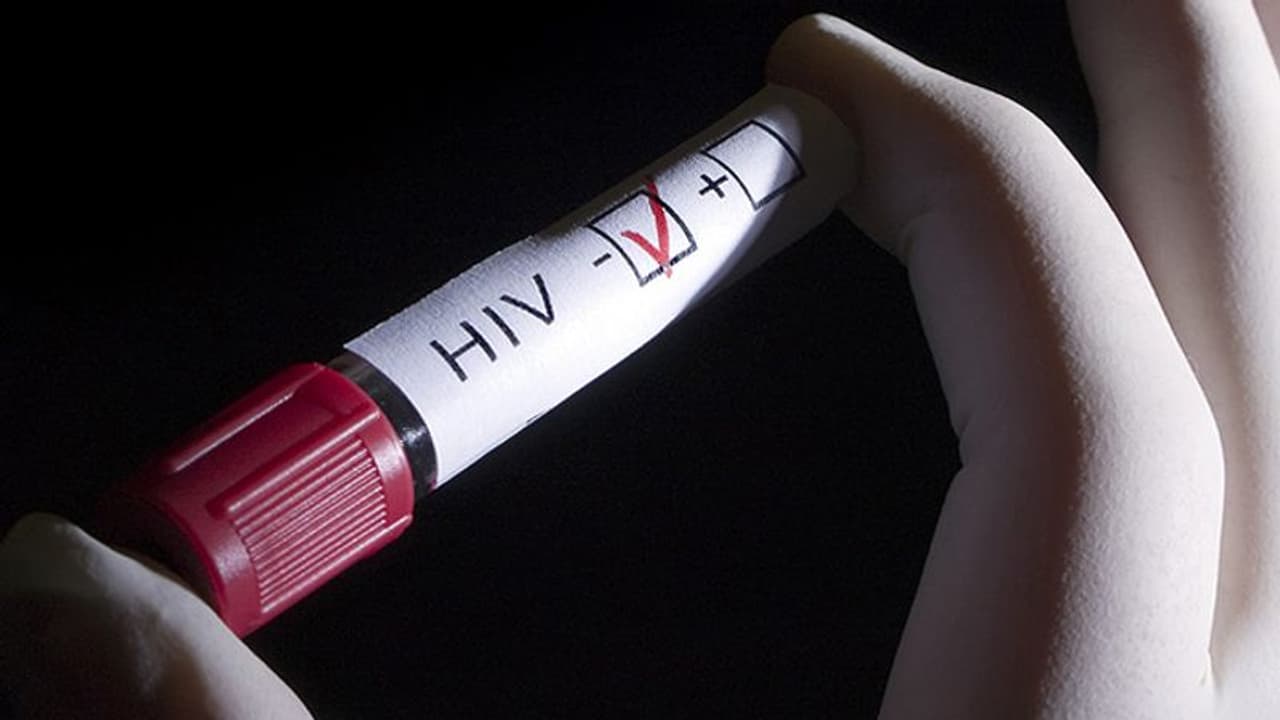 ചുംബനത്തിലൂടെ എയ്ഡ്സ് പകരുമോ..? ചുംബനത്തിലൂടെ എയ്ഡ്സ് പകരുമോ..?