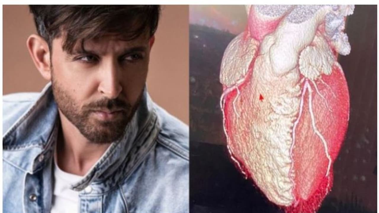 ഹൃദയം പങ്കുവച്ച് ഹൃത്വിക് റോഷൻ, കാരണവും താരം വ്യക്തമാക്കുന്നു! ഹൃദയം പങ്കുവച്ച് ഹൃത്വിക് റോഷൻ, കാരണവും താരം വ്യക്തമാക്കുന്നു!